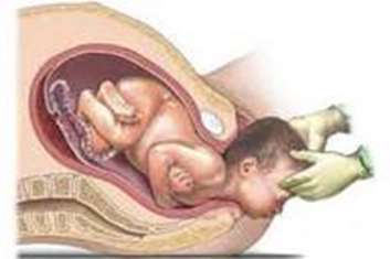 نقش بیمارستان شهید سردارسلیمانی در حمایت از جوانی جمعیت با ترویج زایمان طبیعی بدون درد